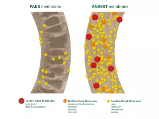 AN69 membrane